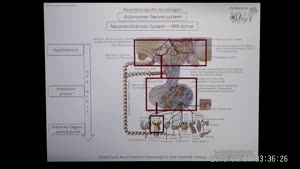 Miniaturansicht - PNEI-Modul-W17-Vorlesung-Neurobiologie-Endokrinologie-Teil-3.2-Folienerklärung02